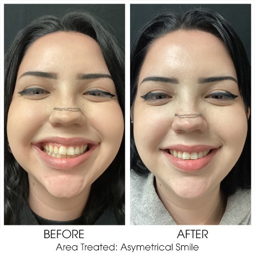Before + After Gallery: Face