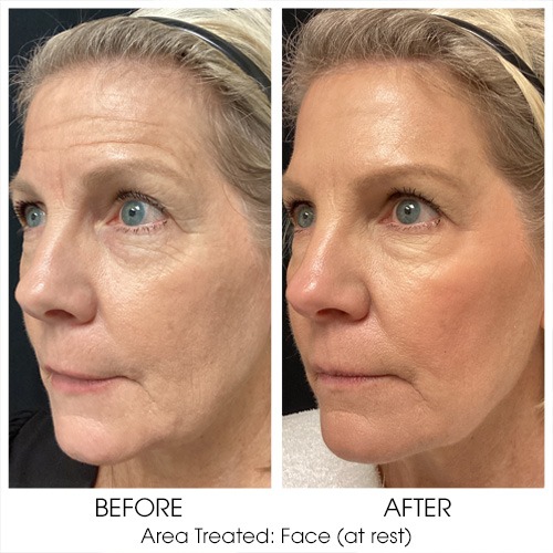 Before + After Gallery: Face