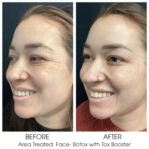 Before + After Gallery: Face