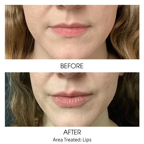 Before + After Gallery: Face