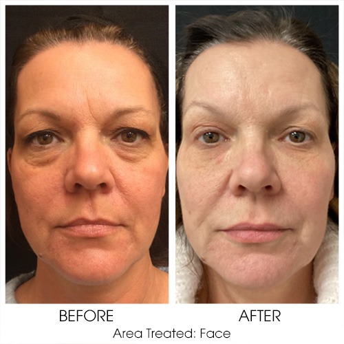 Before + After Gallery: Face