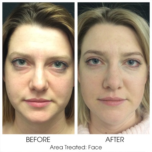 Before + After Gallery: Face