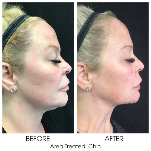 Before + After Gallery: Body