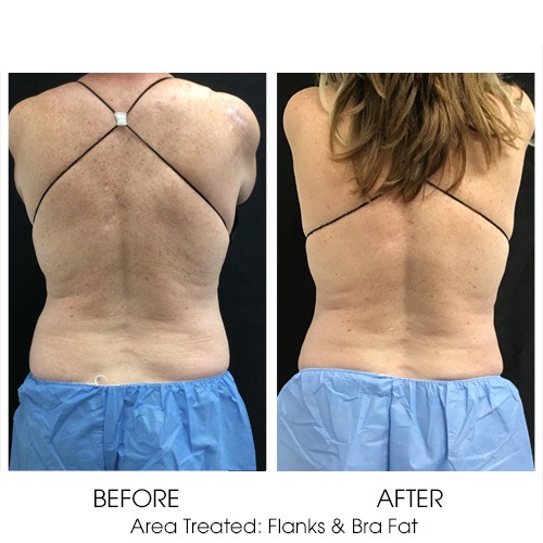 Before + After Gallery: Body
