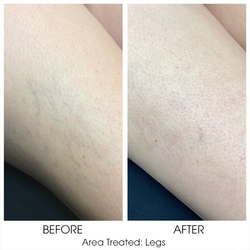 Before + After Gallery: Body
