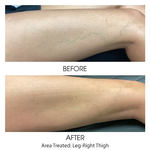 Before + After Gallery: Body