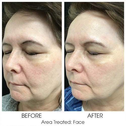 Before + After Gallery: Face