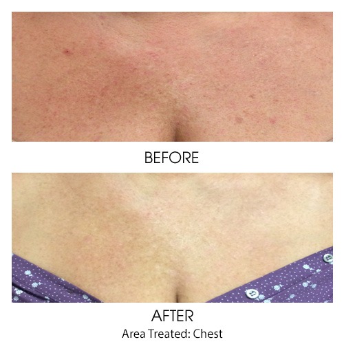 Before + After Gallery: Face