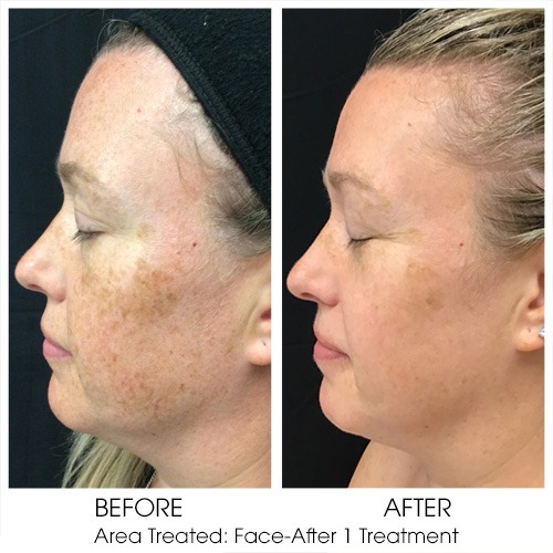 Before + After Gallery: Face