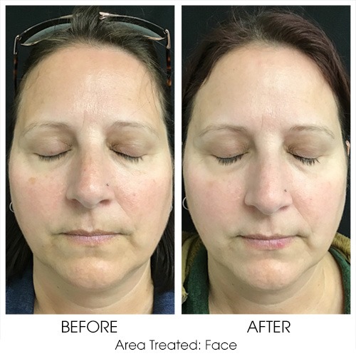 Before + After Gallery: Face