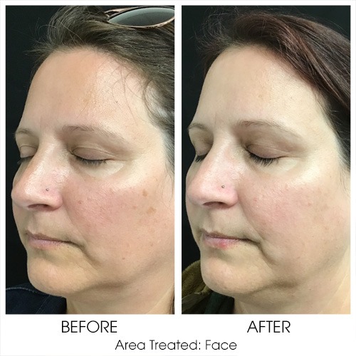 Before + After Gallery: Face