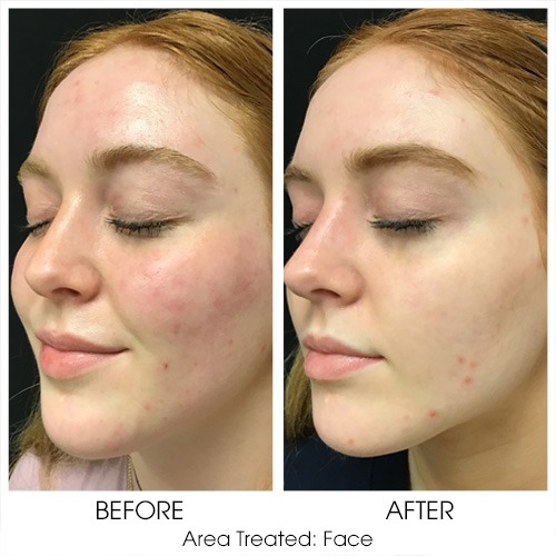 Before + After Gallery: Face