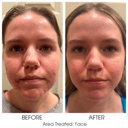 Before + After Gallery: Face