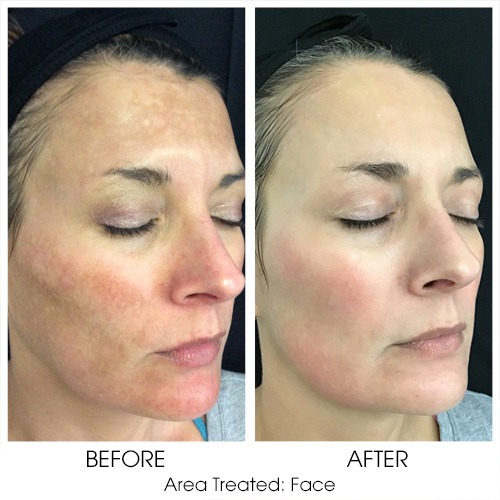 Before + After Gallery: Face