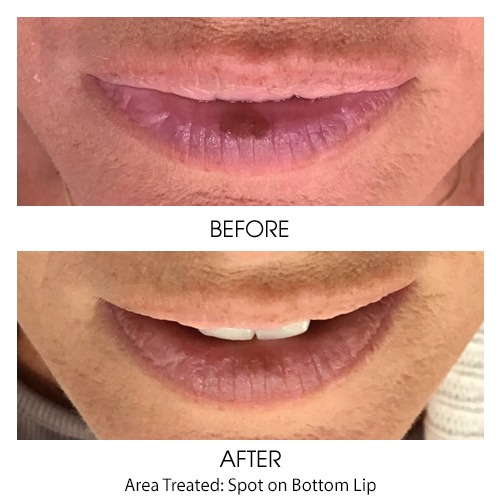 Before + After Gallery: Face