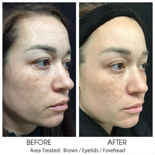 Before + After Gallery: Face