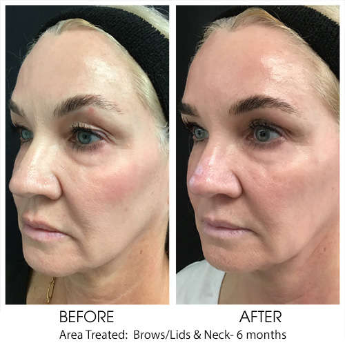 Before + After Gallery: Face