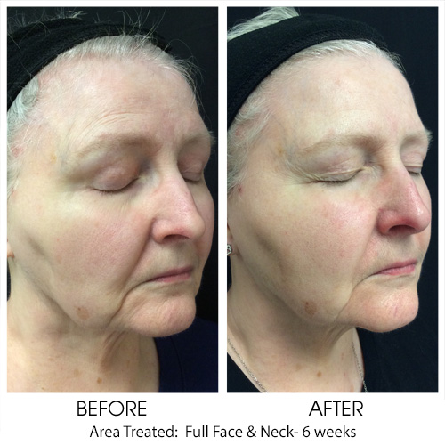 Before + After Gallery: Face