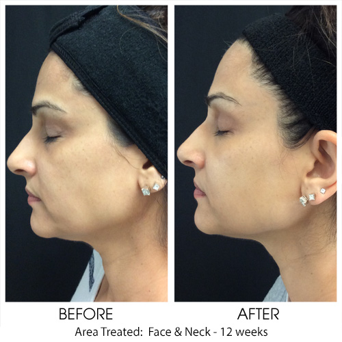 Before + After Gallery: Face