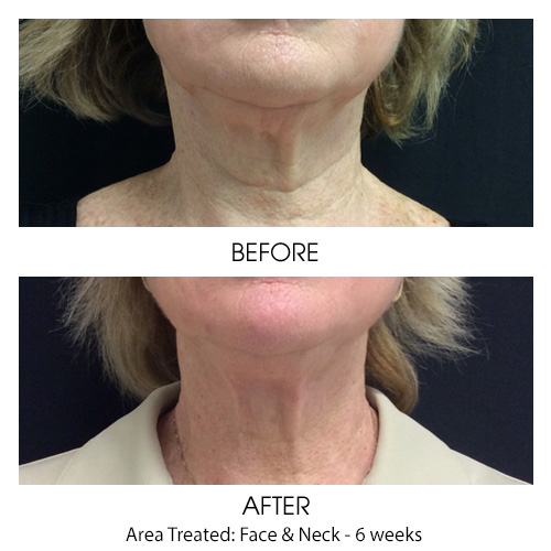 Before + After Gallery: Face
