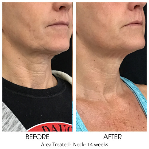 Before + After Gallery: Face