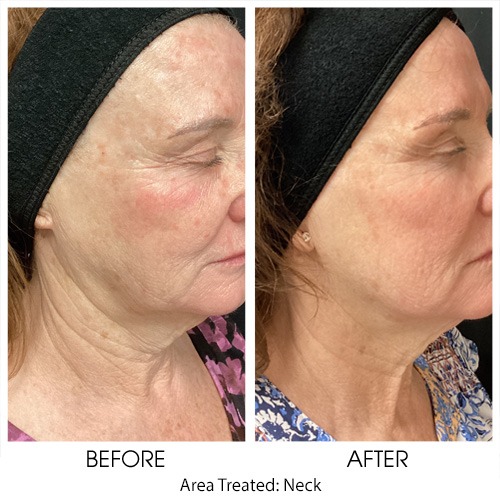 Before + After Gallery: Face