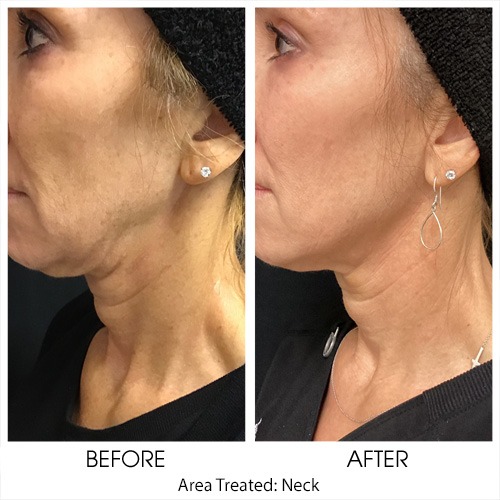 Before + After Gallery: Face