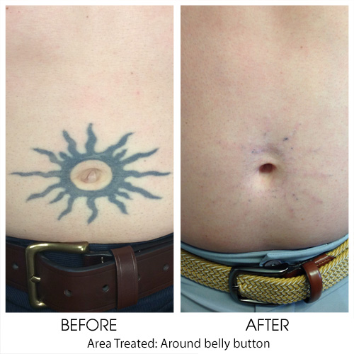 Before + After Gallery: Body