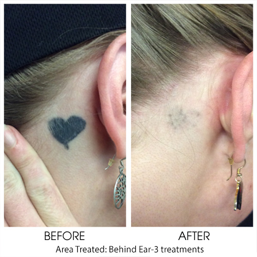 Before + After Gallery: Body