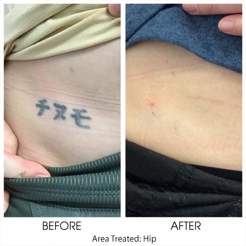 Before + After Gallery: Body