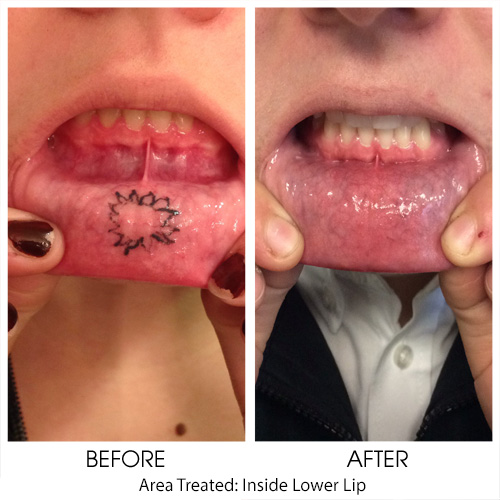 Before + After Gallery: Body