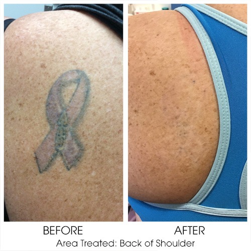 Before + After Gallery: Body