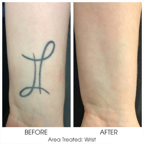 Before + After Gallery: Body