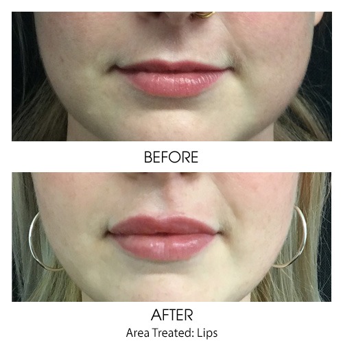 Before + After Gallery: Face