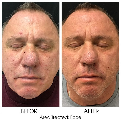 Before + After Gallery: Face