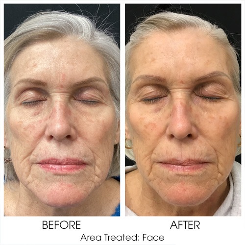 Before + After Gallery: Face