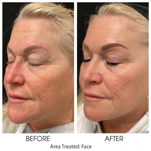 Before + After Gallery: Face