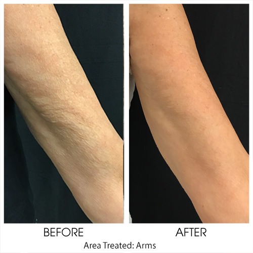 Before + After Gallery: Face