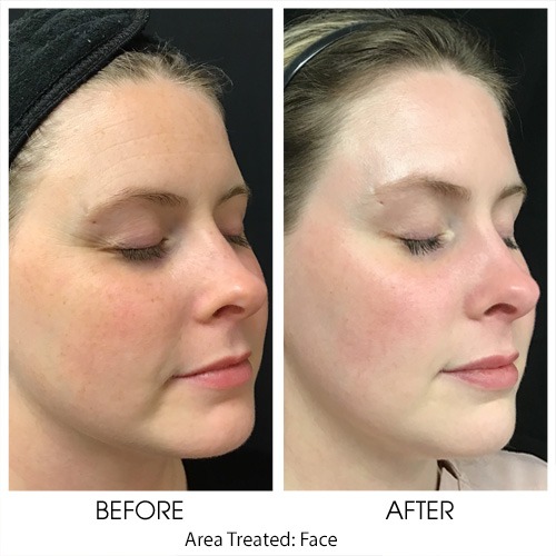 Before + After Gallery: Face