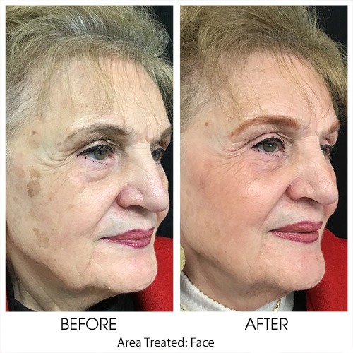Before + After Gallery: Face