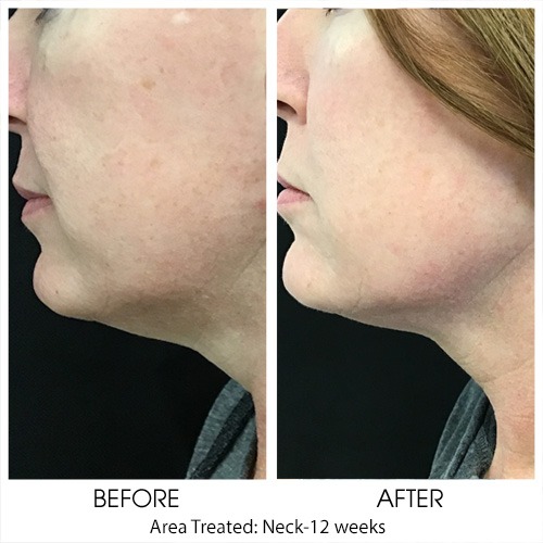 Before + After Gallery: Face